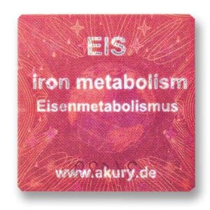 EIS